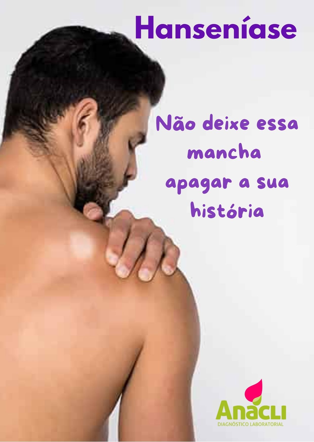 Dia Internacional do Hanseniano: informação que salva vidas! Dia Internacional do Hanseniano: informação que salva vidas!